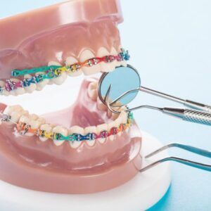 Orthodontic Supply